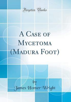 Read A Case of Mycetoma (Madura Foot) (Classic Reprint) - James Homer Wright file in ePub